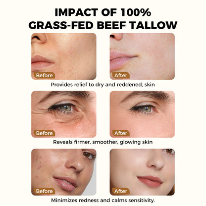 Organic Grass Fed Beef Tallow Moisturizer 4.23oz Hydrating Cream for Dry Sensitive Skin